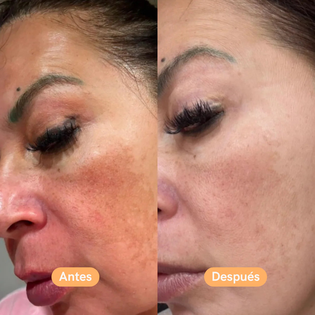 Mascara LED Recargable 7 en 1 - Renueva tu piel en semanas