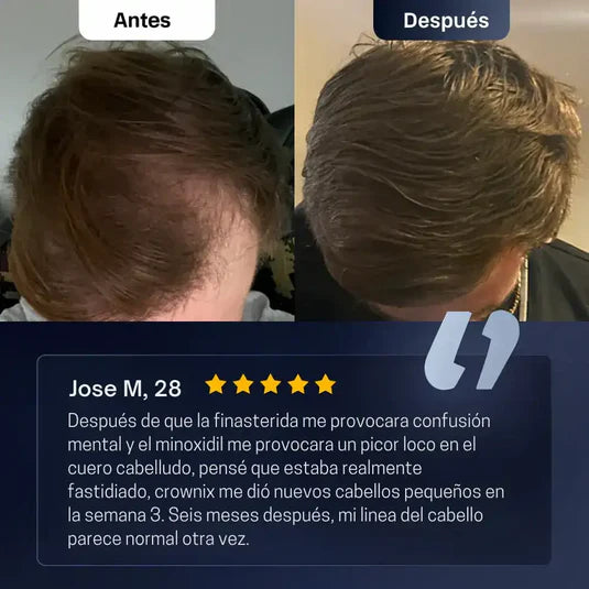 Sérum capilar que impulsa el crecimiento y fortalece la raíz - Bodywise